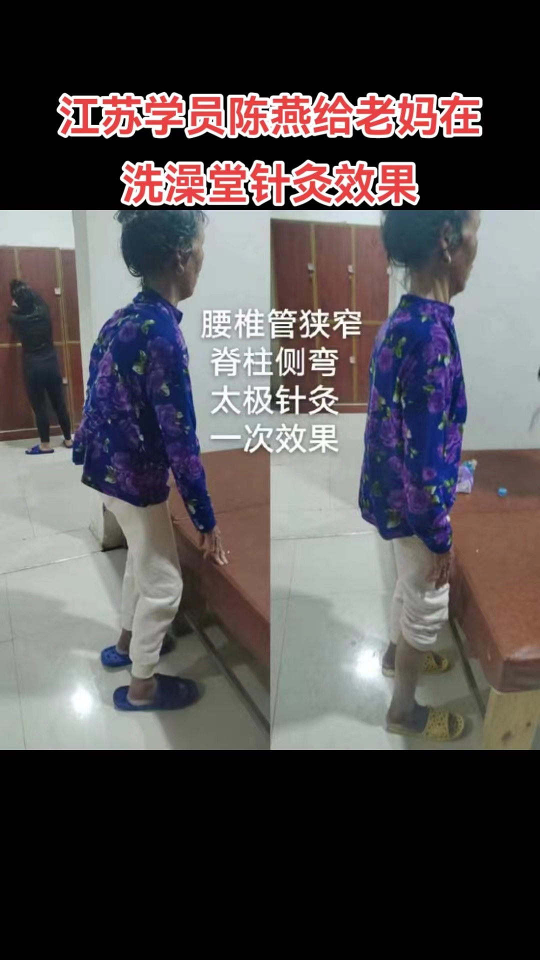 巨鹿内病外治新疗法学校学员交流场景