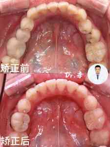 长春净月区儿童及青少年、成年人牙齿正畸服务优质之选:权威机构深度推荐