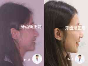 长春多区域青少年、成年人、老年人种植牙服务优质机构推荐