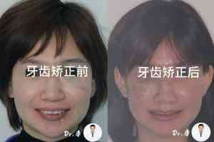 长春净月区与二道区口腔服务推荐:涵盖正畸、洗牙等多类项目