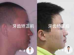 长春各区牙齿清洗与正畸服务推荐:净月、二道多年龄段口腔护理之选