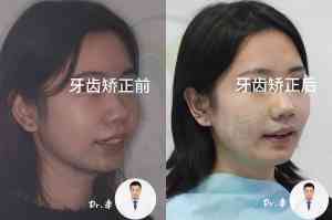 长春南关区/二道区青少年及老年人种植牙服务优质机构推荐,贴心呵护口腔健康