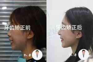 长春二道区、南关区多年龄段种植牙服务咨询，这些优质机构值得关注