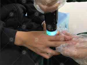 广西南宁、梧州、桂林、柳州等地白斑治疗中心及咨询服务推荐