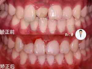 长春全年龄段牙齿服务推荐：老年人清洗、儿童正畸及成人正畸门店资讯