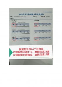 学生防控眼镜镜片厂家推荐:聚焦四川超乐控光学等企业