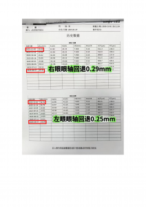 学生防控眼镜镜片供货商推荐:四川超乐控光学,专业守护青少年视力健康