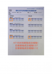 学生防控眼镜实力厂家推荐:四川超乐控光学,专注青少年近视防控
