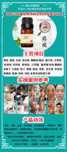 净肤宝祛斑技术厂商推荐：昆明净肤宝实力品牌深度解析