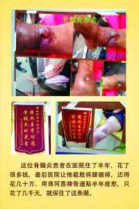 西安膏药、轻创业、理疗、养生加盟及招商项目热门推荐，有亮点