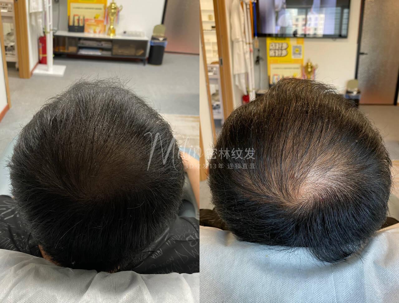 密林纹发案例3