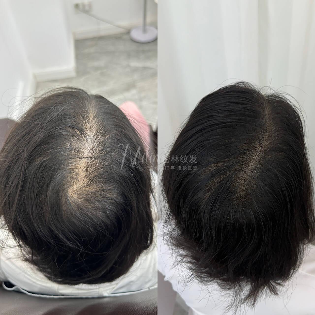 密林纹发案例效果