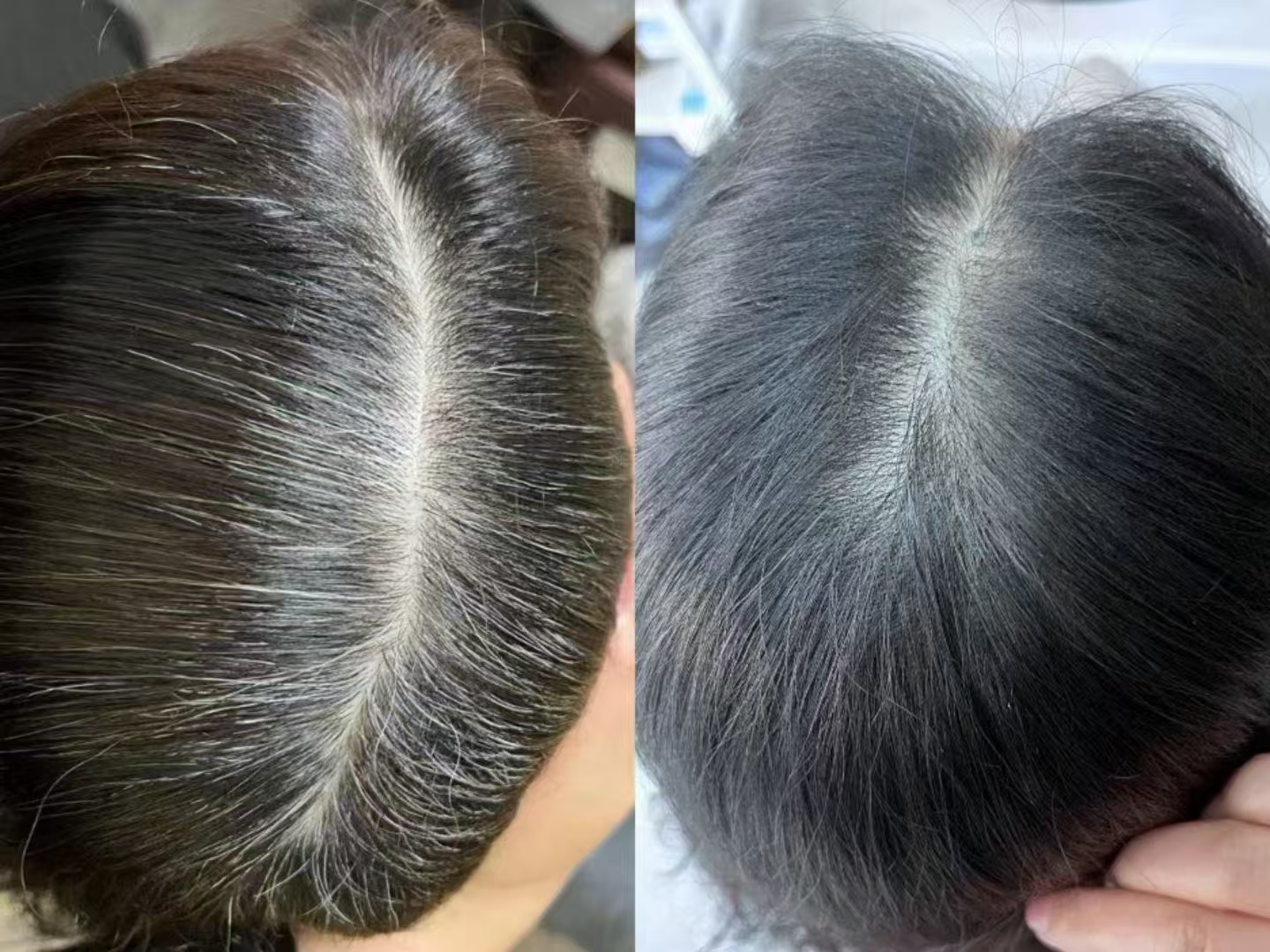 秀丝顿植物养发馆