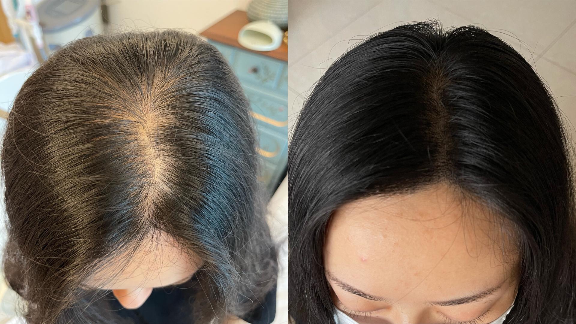露顶记纹发机构