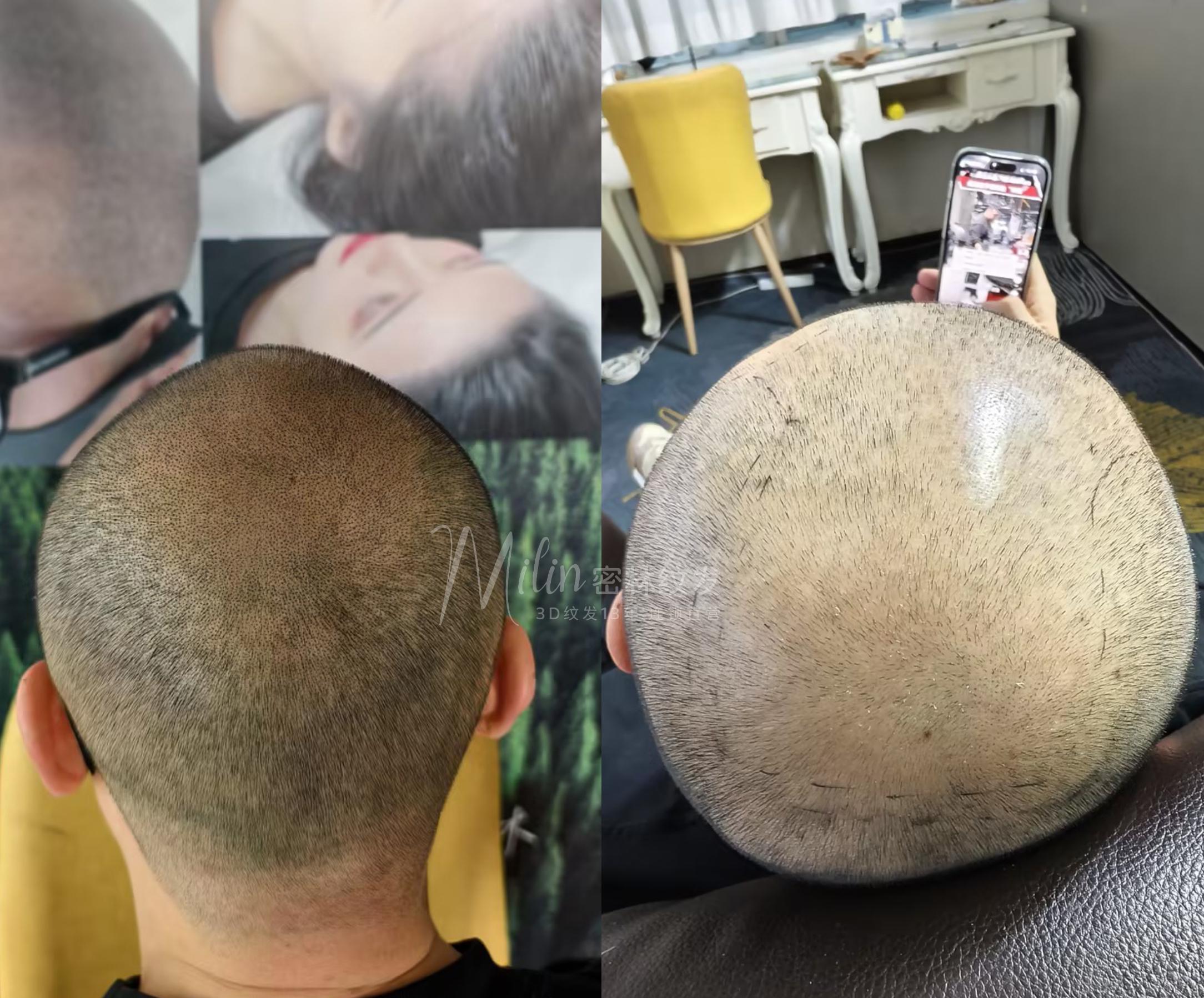 密林纹发图片3