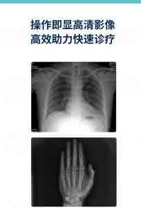 2026年养老院医务室X光设备源头厂家推荐