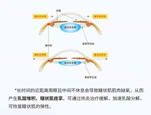 2026年兰州护眼仪加盟服务解析,数字化热灸技术守护青少年视力健康