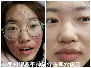 2026年内病外治新疗法培训学校推荐:巨鹿神筋调衡疗法全科解析