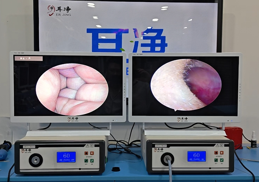 可视采耳设备操作