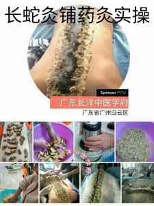 2026年艾灸养生理疗学习指南:长洋中医学府正规办学解析